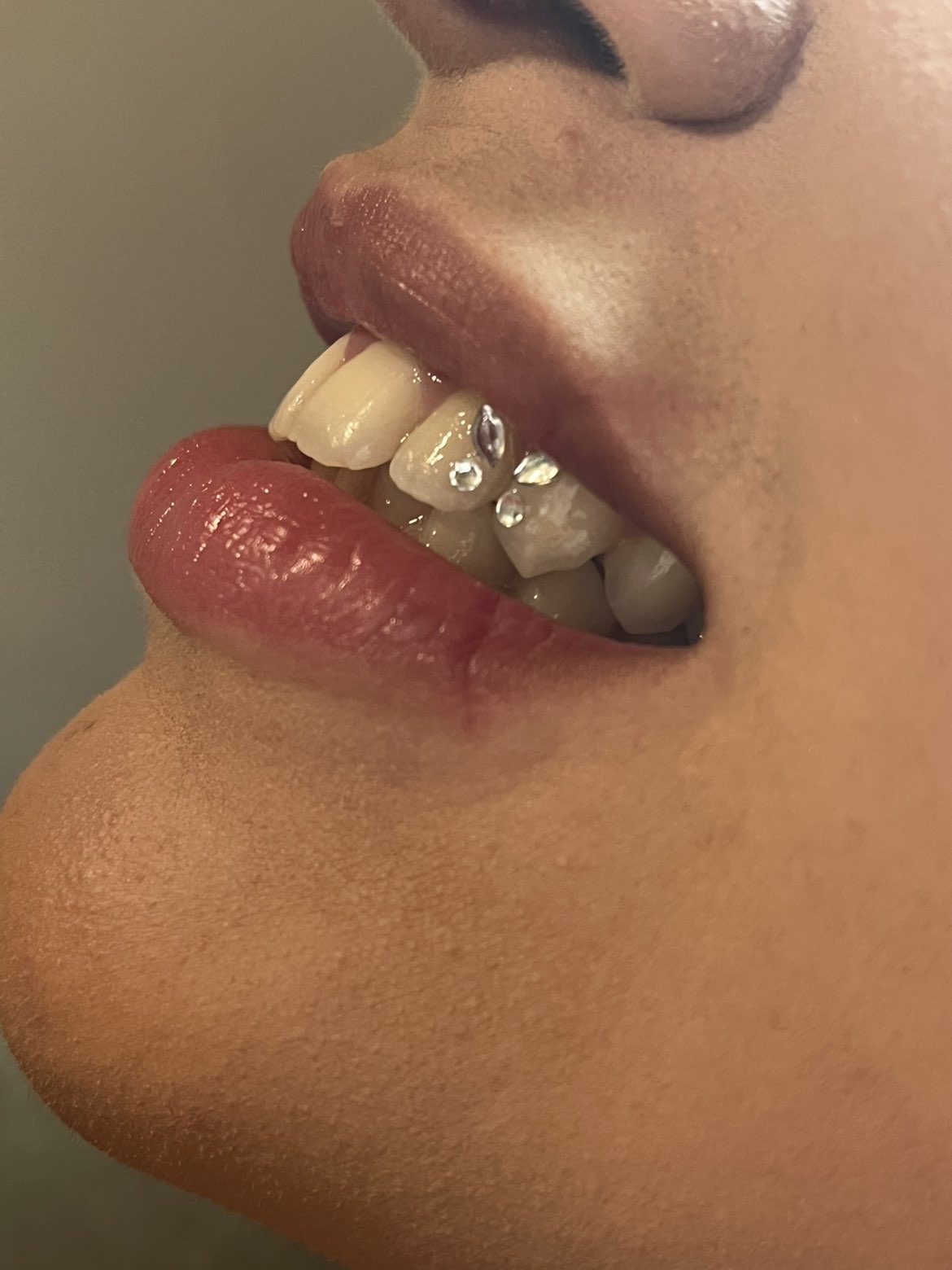 Toothgems met meerdere steentjes